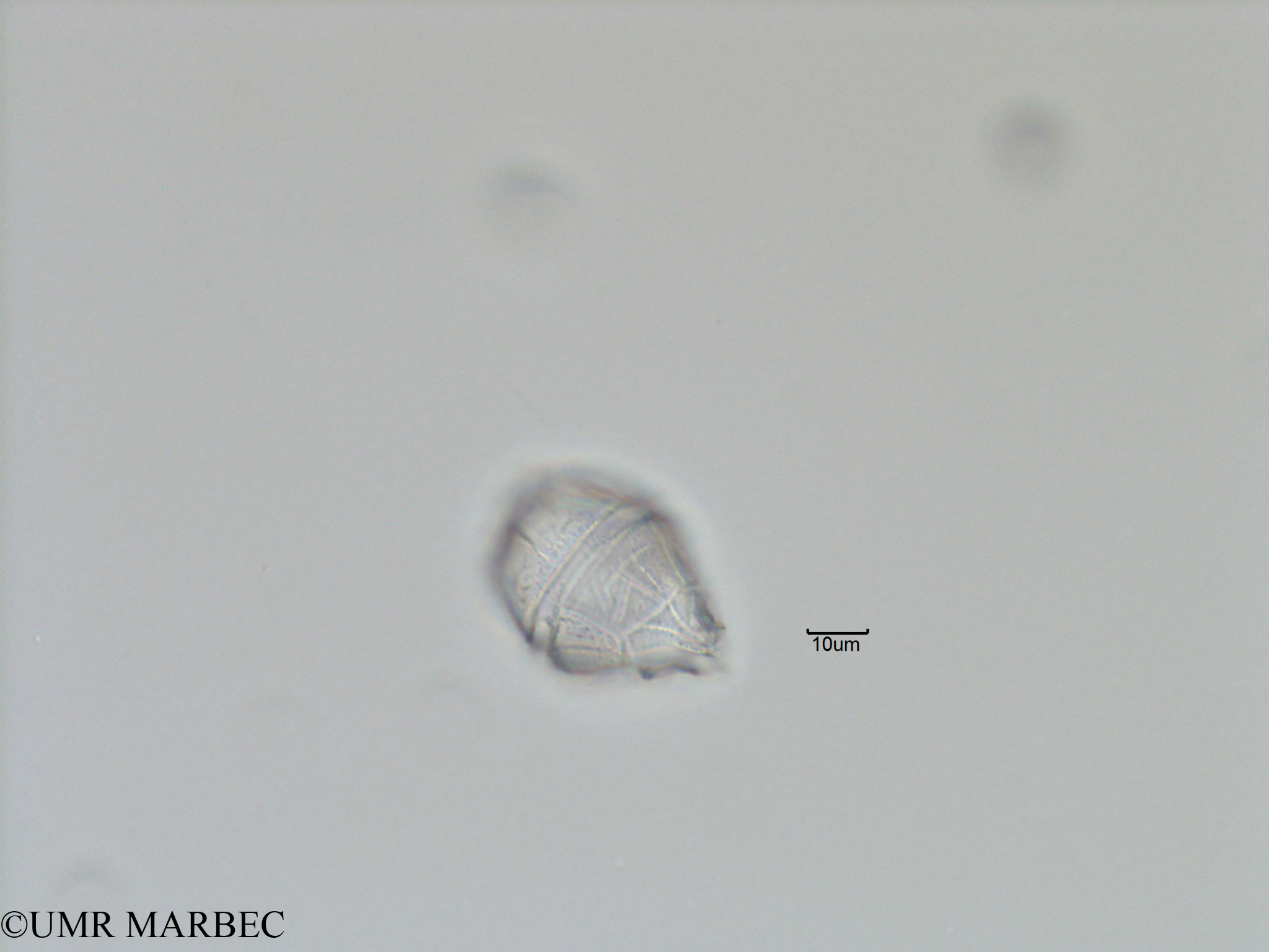 phyto/Bizerte/bizerte_bay/RISCO November 2015/Gonyaulax sp11 (Baie_T5-C2-Gonyaulax cf spinifera-1).tif(copy).jpg